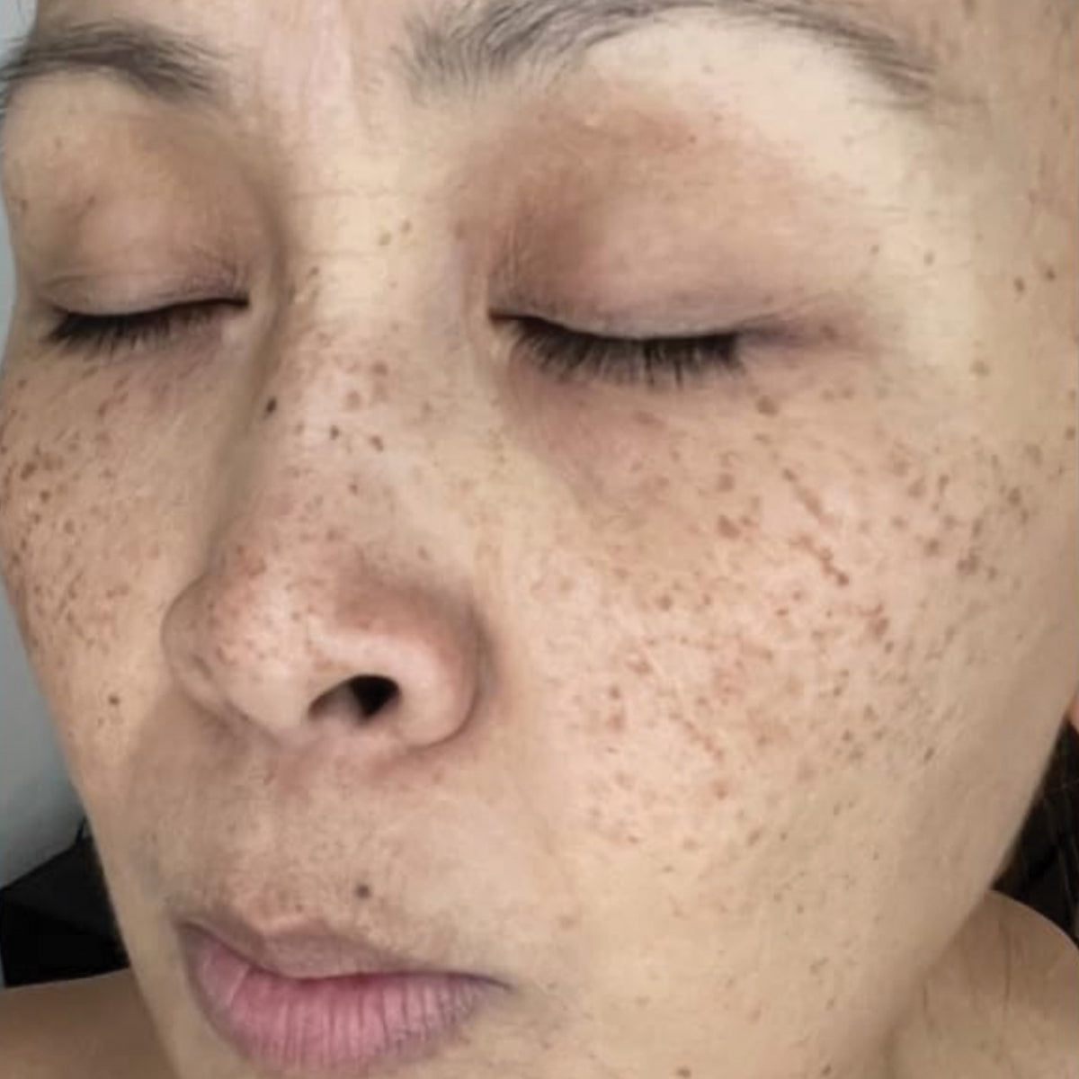 Skin before use