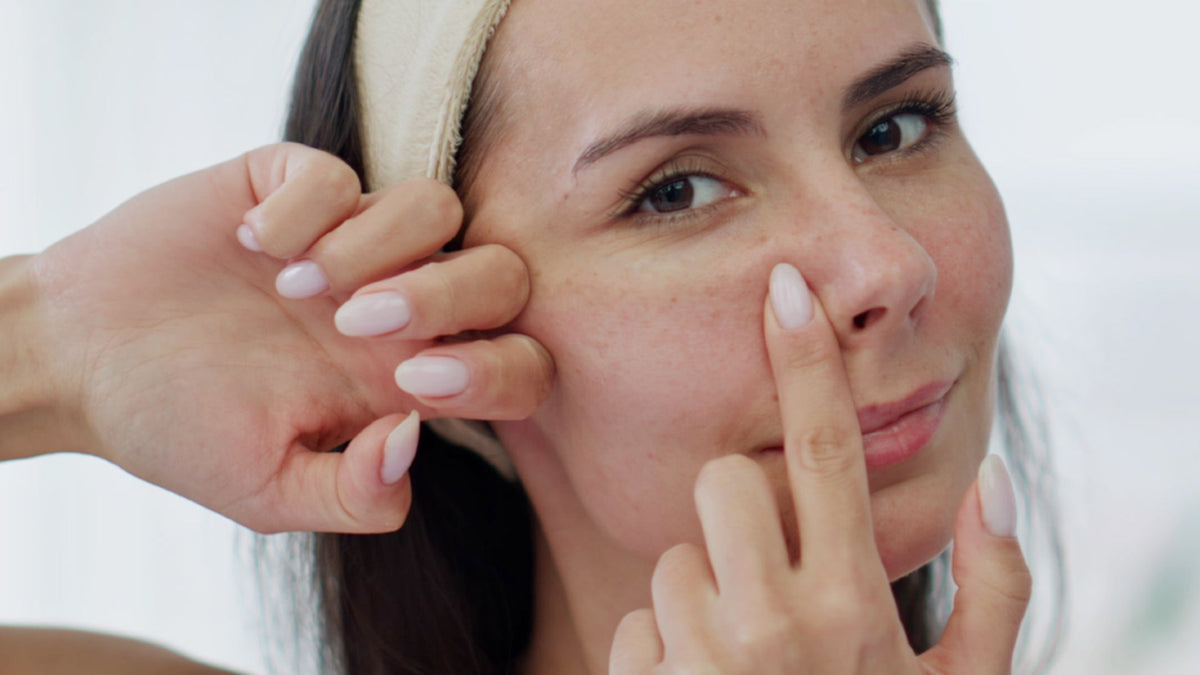 The Best Vitamin C Serums for Acne Prone Skin 2026