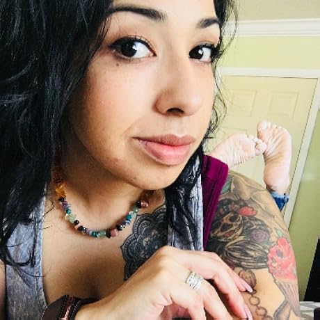 Miracle for acne scars and hyperpigmentation!!