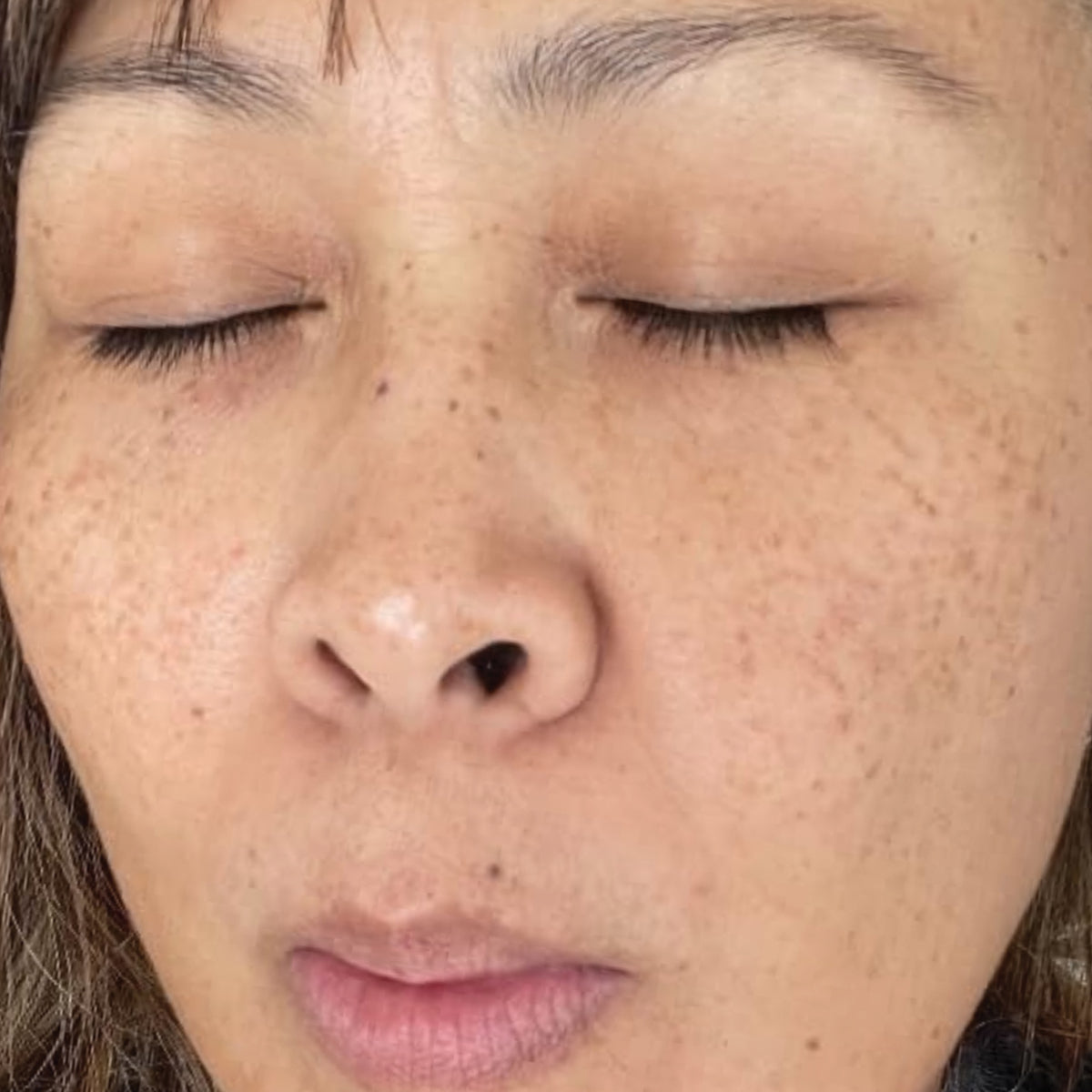 Skin after use