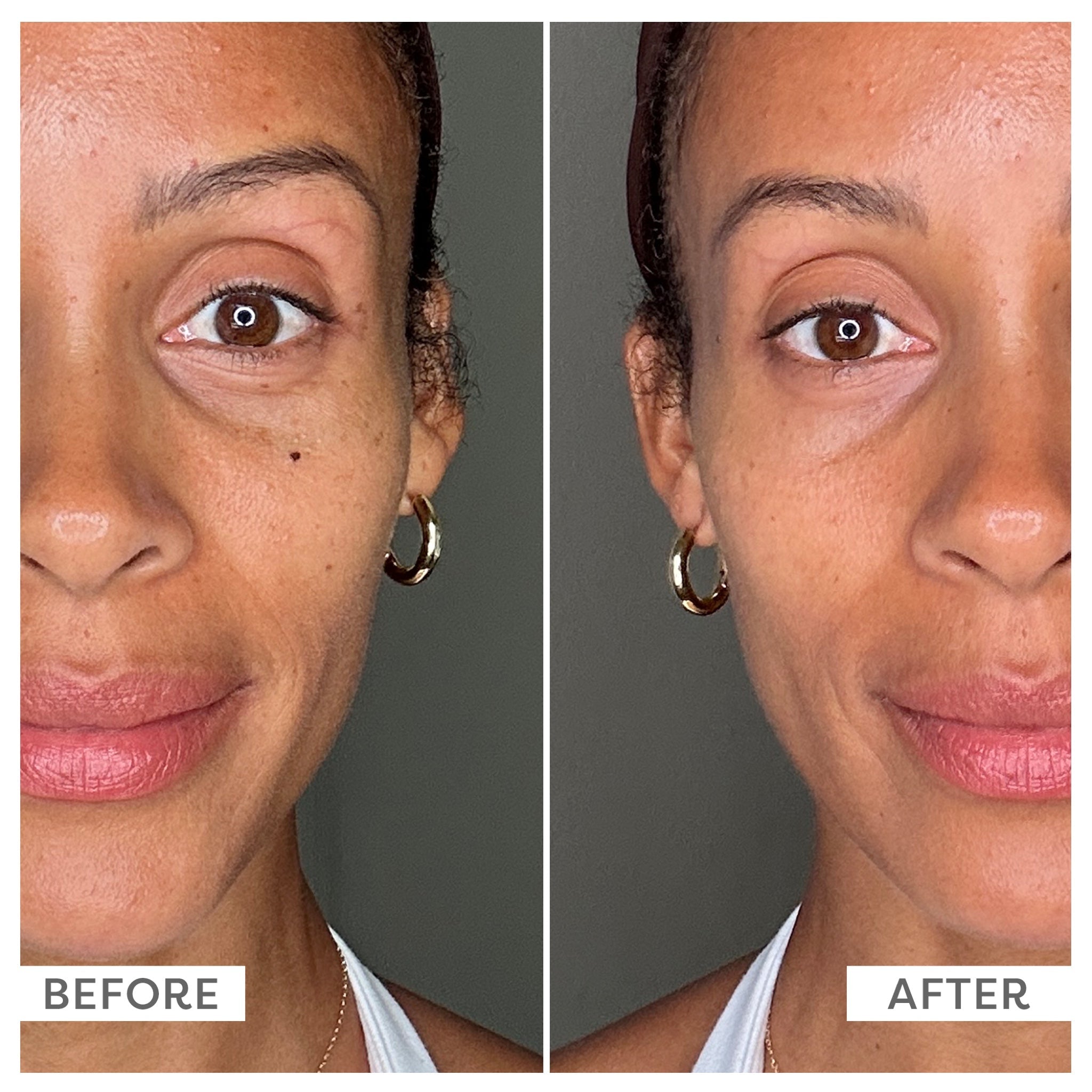 SPF 30 Mineral Sunscreen Serum — before and after use